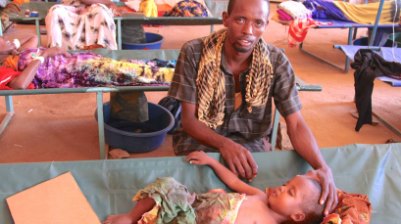 UNICEF says some malnourished Somali children "are nine times more likely to die of cholera, or diarrhoea or measles. Picture:UN