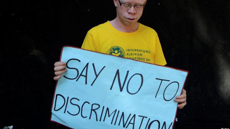 The SACP is working with communities to fight against the killing of people albinism.