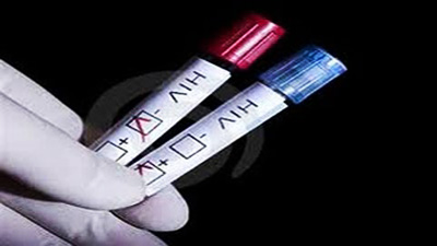 HIV testers