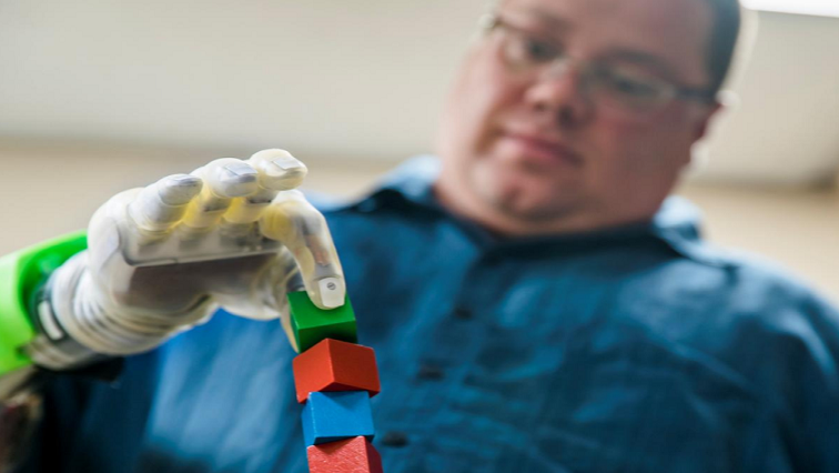 In an innovative experiment, scientists have shown that the nerves in patients’ arms can be trained to control the movements of prosthetic fingers and thumbs.