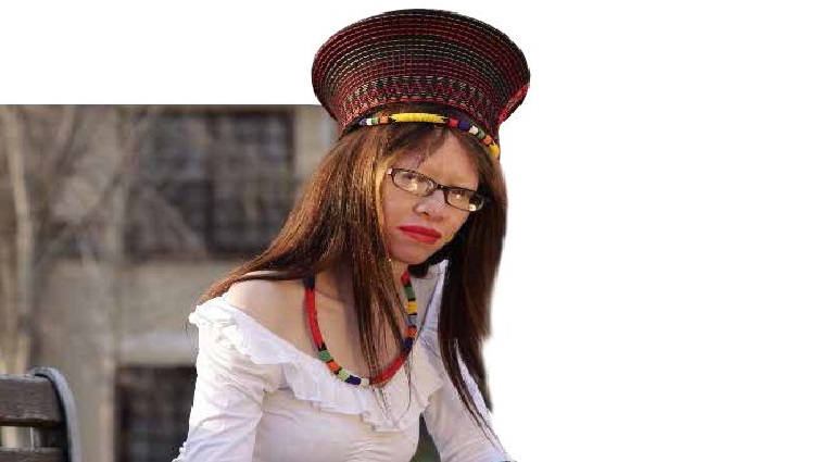 Sethibe says education will help dispel some of the myths about people with Albinism. 