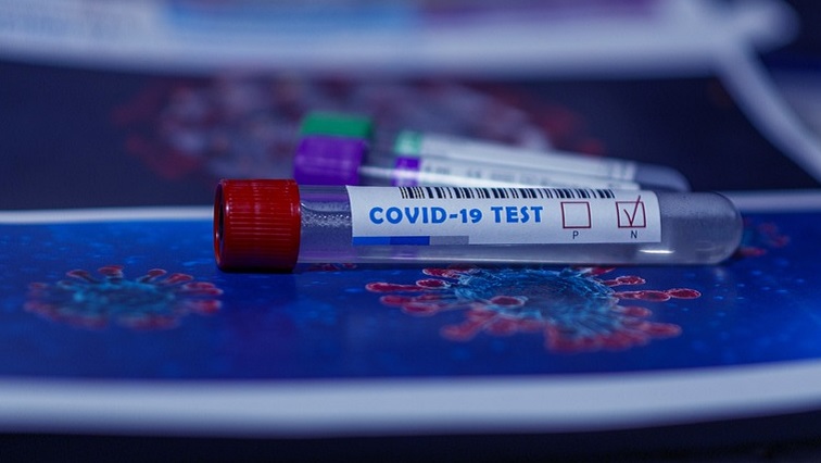 The Western Cape has recorded 2 913 new coronavirus cases followed by KwaZulu-Natal with 2 270 and Gauteng with 1 690 new cases on Sunday.