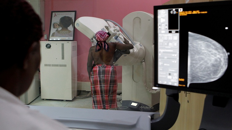 The model estimates that biennial mammograms for Black women starting at age 40 would reduce the gap in breast cancer mortality when compared with white women by 57%.