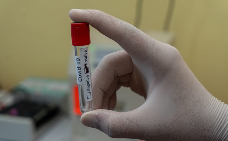 A medical worker holds a test tube with a positive COVID-19 test