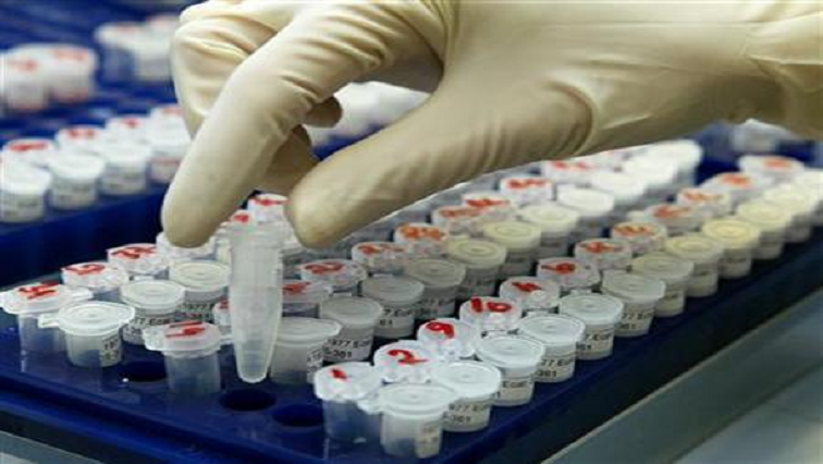 Backlog dalam tes DNA di Laboratorium Ilmu Forensik Kepolisian: Kementerian Kepolisian – SABC News