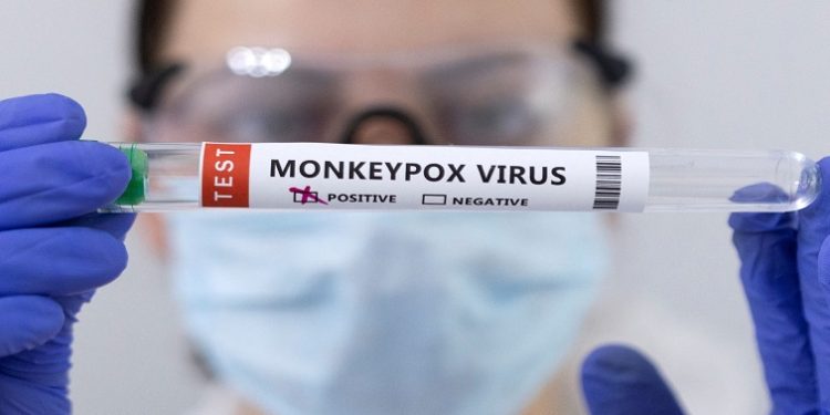 Test tubes labelled "Monkeypox virus positive" are seen in this illustration taken May 23, 2022. REUTERS/Dado Ruvic/Illustration