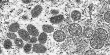 FILE PHOTO: An electron microscopic (EM) image shows mature, oval-shaped monkeypox virus particles as well as crescents and spherical particles of immature virions, obtained from a clinical human skin sample associated with the 2003 prairie dog outbreak in this undated image obtained by Reuters on May 18, 2022.