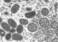 FILE PHOTO: An electron microscopic (EM) image shows mature, oval-shaped monkeypox virus particles as well as crescents and spherical particles of immature virions, obtained from a clinical human skin sample associated with the 2003 prairie dog outbreak in this undated image obtained by Reuters on May 18, 2022.