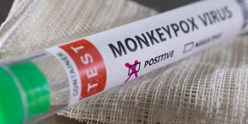 A test tube with a positive Monkeypox sticker
