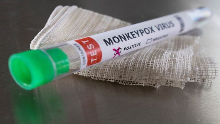 Test tube labelled "Monkeypox virus positive" are seen in this illustration.