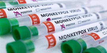 Test tubes labeled "Monkeypox virus positive and negative" are seen in this illustration.