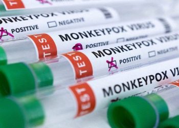 Test tubes labeled monkeypox virus positive