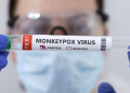 Test tubes labelled "Monkeypox virus positive are seen in this illustration