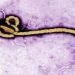 A microscopic image of the eBola virus.