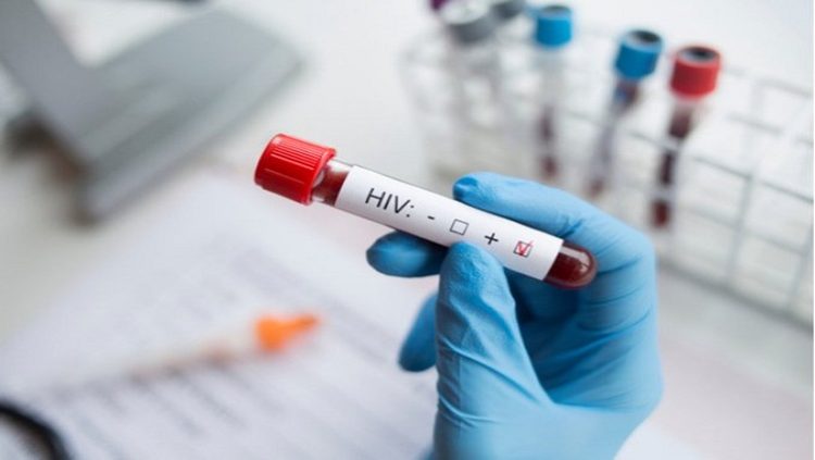 HIV test blood sample.