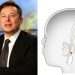 Musk's company is developing brain chip interfaces that it says could enable disabled patients to move and communicate again.