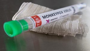 Monkeypox positive